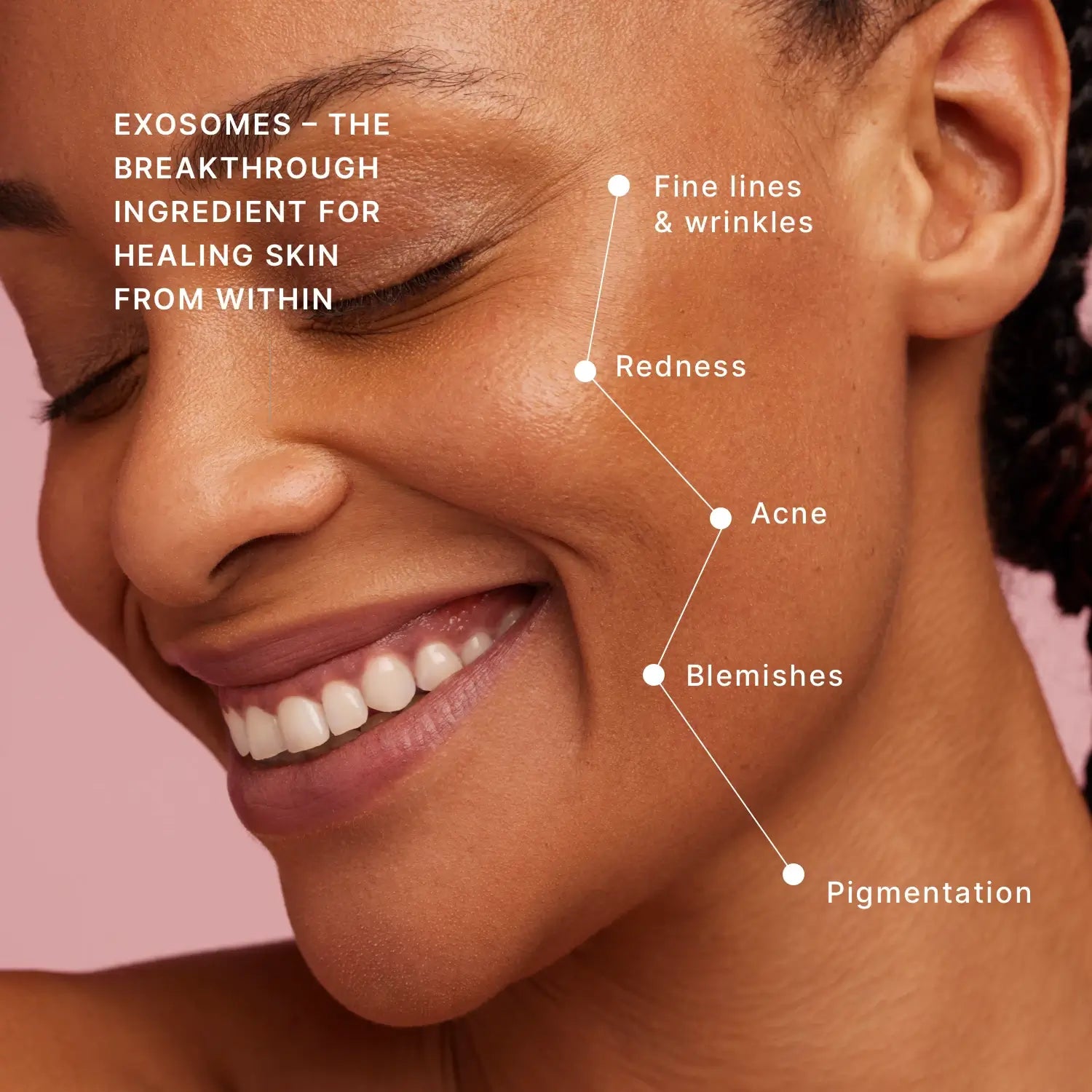 Dr Ivy Exosome Serum — suitable for face and neck