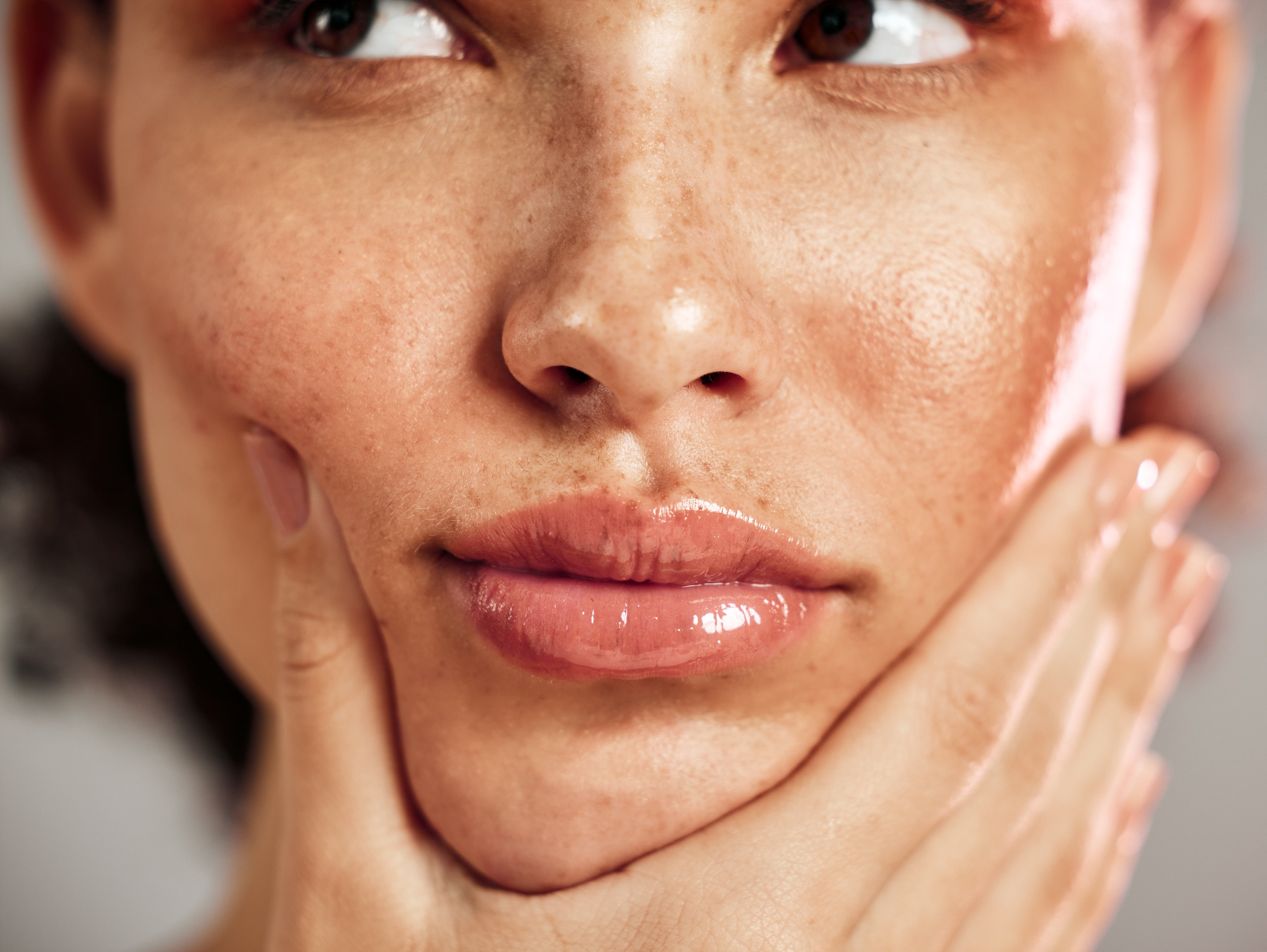 Sun spots, also called age spots, on adult's face.